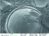 Figure 17 - A perfume particle/polyethylene stabilized in a structured emulsion, as viewed by scanning electron microscopy