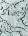 Figure 4 - As-cast bainitic cast iron (etched sample, magnification 300)