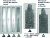 Figure 8 - Effect of pre-refining on shrinkage and grain size in AlSi11Mg alloy