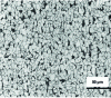 Figure 17 - Optical micrograph of the microstructure of a Dual-Phase steel (photo ArcelorMittal Global R&D Maizières)