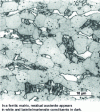 Figure 20 - Microstructure of a TRIP steel obtained by optical microscopy after dye etching (photo ArcelorMittal Global R&D Maizières).