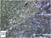 Figure 22 - Example of microstructure of bainitic hot-rolled steel without carbides (Rm = 1,300 MPa; A% = 14%) (optical micrograph ArcelorMittal Global R&D Maizières)