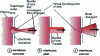 Figure 20 - Extracted ion beam geometry according to the shape of the plasma meniscus at the diaphragm