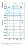 Figure 11 - Monotectic diagram generated by the intersection of a miscibility gap in the liquid phase with a liquidus