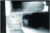 Figure 7 - Scarfing operation on a bloom in the hot rolling mill