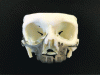 Figure 7 - Maxillary reconstruction implant in TiAl6V4 alloy manufactured by LBM process with a Renishaw RenAM 500M machine (Wotton-under-Edge, Gloucestershire, United Kingdom) (Credit 3D Medlab (Marignane, France), project carried out in collaboration with Frohman Care (Metz, France))