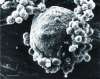Figure 4 - SEM micrograph of a hydroxyapatite (HA) ceramic particle to which antigen-presenting cells adhere (scale bar: ...
