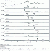 Figure 10 - MEKC-MS analysis of 12 estrogenic compounds in wastewater spiked at 0.6-2 μg · L–1 after a dispersive liquid-liquid microextraction step and an electrokinetic preconcentration step [54]