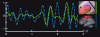 Figure 2 - Brain activity consistent with hand speed (after Jerbi et al. [2])