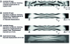 Figure 27 - Numerical simulations (finite element software, rectangular mesh (100 x 40 nodes)) and experimental image for a plate subjected to a three-point bending test (plane stress).