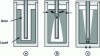 Figure 8 - Solid-liquid interface displacement in the case of melting