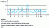 Figure 17 - Signal measurement by photoelectron counting.
Selection of signal pulse             amplitude