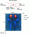 Figure 15 - Analysis of plasma created by laser-matter interaction (inertial confinement experiment) (based on document CEA-DAM, Limeil-Valenton Research Center)