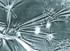 Figure 2 - Fibroblasts adhering to a flexible substrate (the "lines" are the folds of the substrate)