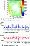 Figure 4 - Local heat flow