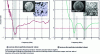 Figure 7 - Acoustic refractive index in suspensions of porous silicone and porous silica particles