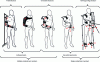 Figure 2 - Illustration of the different kinematics of existing exoskeletal structures