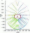 Figure 26 - Effect of varying the force applied to the end effector for several initial positions (marked by red dots) for the RFRFR robot, in mode 1. Blue and green areas show end effector displacements around initial positions (different colors are used to distinguish superimposed areas).