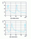 Figure 30 - Electrical impedance of the loudspeaker loaded by a short column (L = 1 m)