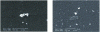 Figure 14 - Polymer wear particles from inflammatory pannus (according to [31])