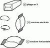 Figure 5 - Packaging made with cast PP film and co-extruded OPP film