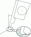 Figure 2 - Typical diagram of a squeegee