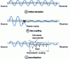 Figure 3 - General principles of vibration reduction: the difference between decoupling and damping