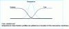 Figure 7 - Structure of a jet flame reaction zone (figure )