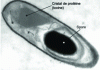 Figure 2 - Photo of a Bacillus thuringiensis spore-forming cell