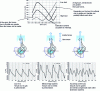 Figure 39 - Schematic approach to the evolution of engine torque (harmonic 2) with speed