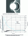 Figure 13 - Example of a semi-analytical simulation of the interaction between a cylindrical or plane wave and an immersed circular elastic shell [1] [9] [11]