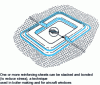 Figure 15 - Reinforcement around openings (doors, portholes, inspection hatches) in thin sheet metal (source: Vantico)