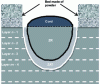 Figure 15 - Cross-sectional view of a weld bead after solidification