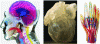Figure 24 - Examples of multi-material anatomical models printed using PolyJet