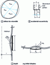 Figure 10 - Imperfection measurement