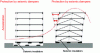 Figure 75 - Comparing the response of isolators and seismic dampers