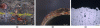 Figure 7 - Pitting (a) on the surface and (b) the fracture surface of a carbon
steel pipe in contact with molten nitrates with the presence  of moisture
(synthetic thermal oil/solar salt heat exchanger), (c) cross section
of an area with grain boundary attack