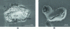 Figure 10 - (a) IM Al7Cu2Fe particle undergoing selective dissolution to form nanometric nodules of pure copper in a 2xxx-type alloy in NaCl medium, (b) IM AlFeSi particle undergoing galvanic coupling at the bottom of pits in a 6xxx-type alloy (micrograph after dissolution of corrosion products).