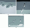 Figure 12 - Examples of defects in OAS anodized layers (thick layers) due to the presence of intermetallic phases in high-alloy alloys: (a) 2024, (b) 7175, (c) 2618