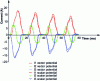 Figure 11 - Evolution of no-load currents in the three primary windings