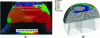 Figure 40 - (a) EBSD image allowing evaluation of the volume of recrystallized solder (the color scale corresponds to the size of the tin grains in µm). (b) Mapping of the elementary inelastic strain energy density calculated by finite element simulation.