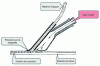 Figure 18 - With fast nozzle