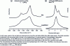 Figure 4 - Effect of drying on the organization of nanocrystalline biomimetic apatites (non-carbonated sample aged 10 min). Observation by transmission FTIR and solid-state NMR of 31P [117]