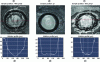 Figure 11 - Changes in ablation quality (photos a, b, and c) and the associated ablation well profile (graphs a′, b′, and c′) as a function of the sample’s position relative to the focal point (fp) of the laser focusing lens (the ablation profiles were obtained along a section indicated in red in each photo)