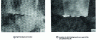 Figure 27 - TEM images of Ni3Nb sprout growth: first stage of grain boundary migration [36].