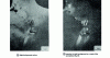 Figure 28 - TEM images of cell formation: alternating lamellae of α/Ni3Nb [36]