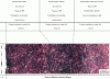 Figure 54 - Optical micrograph of nitrided 32CrMoV13 steel – 55 h at 520°C (KN = 1.62)