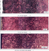Figure 58 - Influence of KN value on the presence of the cementite network below the surface – 32CrMoV13 steel nitrided at 520 °C – 55 h