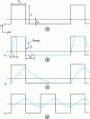 Figure 14 - Influence of charging and discharging times of the interfacial capacitor on the course of the electrode reaction in pulsed mode: increasing effect from (a) to (d) as their ratio to pulse duration increases.