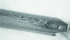 Figure 17 - Initiated breakage on superficial tears